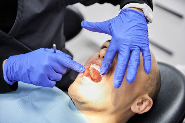Best Emergency Dental Care for Sports Injuries in Salem, NC